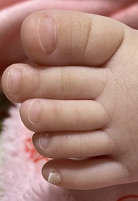 赤ちゃんの爪 もうすぐで7ヶ月になる娘がいます 産まれてからずっと足の Yahoo 知恵袋
