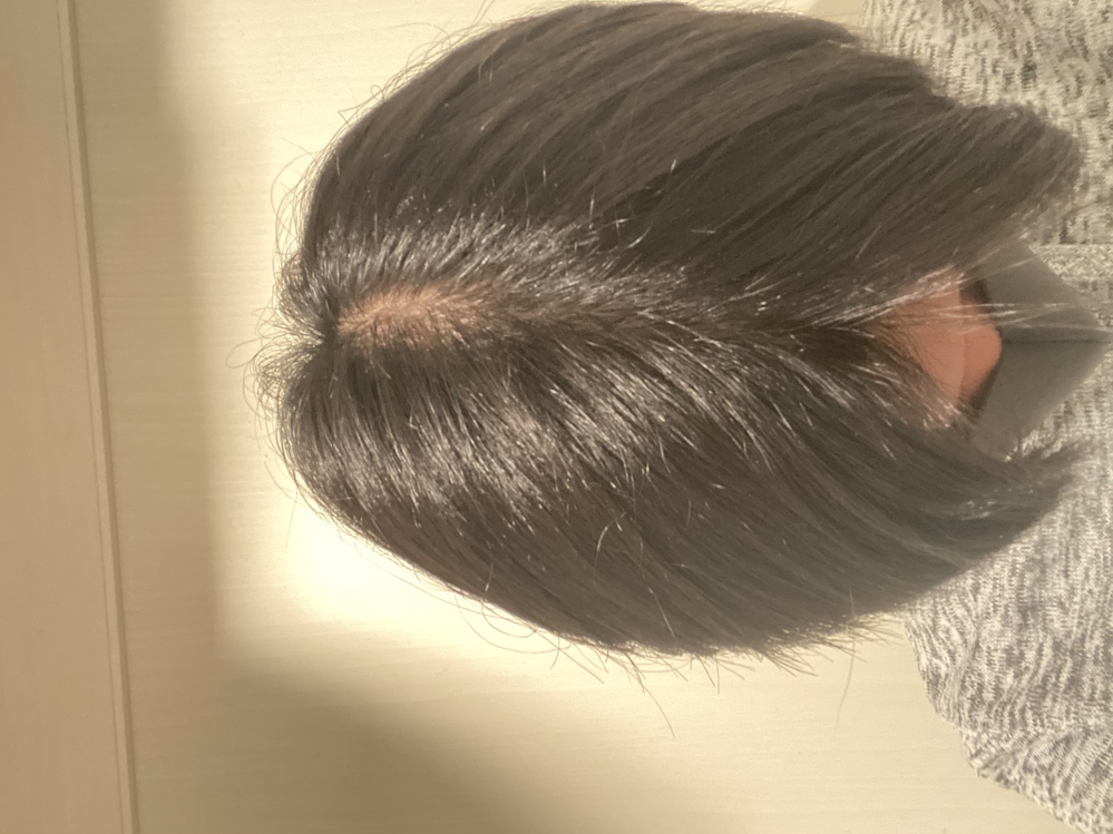 高校生です センター分けをしたら頭皮がすけて見えますこれはハゲでしょう Yahoo 知恵袋