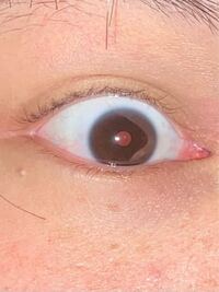 目の病気等に詳しい方にお伺いします この膜のような物は白内障でし Yahoo 知恵袋