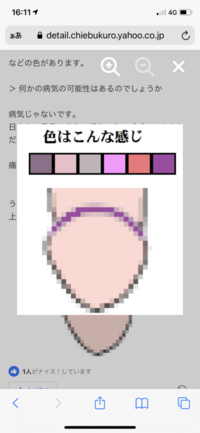 この写真のように陰部の写真の色が着いている部分が1番左のような色をして Yahoo 知恵袋