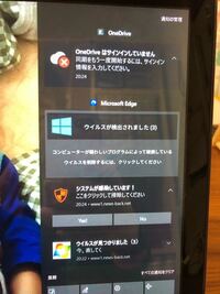 耳に力を入れるとガサガサと異音がします 調べると耳管が開く音と書 Yahoo 知恵袋