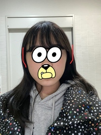 画像のように輪郭がひどいです 鼻の横の部分が凹んでいるのがコンプレック Yahoo 知恵袋