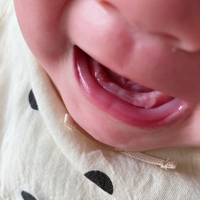 生後5ヶ月の赤ちゃんですが 5日くらい前から歯が生えてきました 今 1ミリく Yahoo 知恵袋