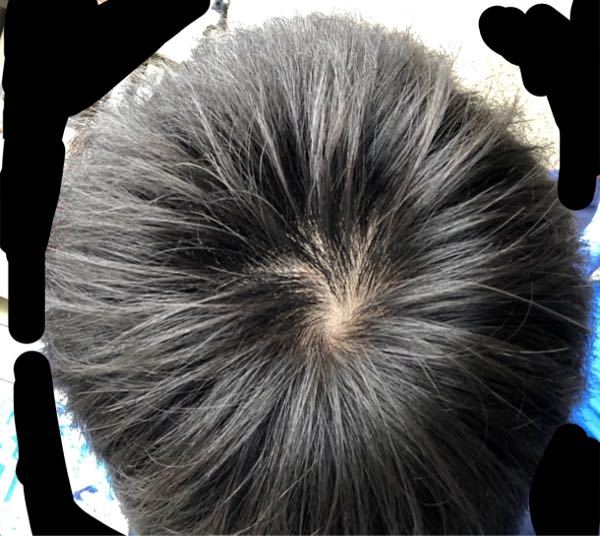 生まれつきから猫っ毛で髪が細いことを自覚してるんですけど こ Yahoo 知恵袋