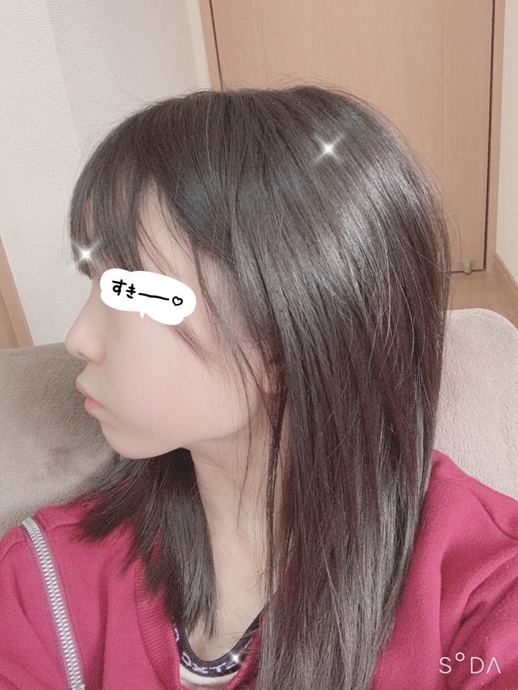 これって口ゴボですか 13年間生きてきて初めて口ゴボぽくない と友達に Yahoo 知恵袋