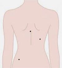 体にホクロが多い人の事どう思いますか 特に背中とか 腕とか 慰めじゃ Yahoo 知恵袋