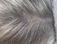 犬の背中ににふけのようなものがあり大丈夫なのか心配です わかりにくいで Yahoo 知恵袋