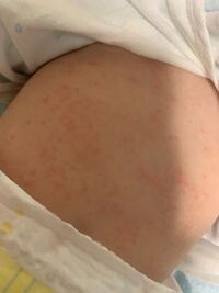 生後5ヶ月 離乳食 今日初めて10倍がゆを小さじ2杯あげました 数 Yahoo 知恵袋