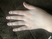 中二女子です最近指の骨 を鳴らすのが癖になってしまっていて Yahoo 知恵袋