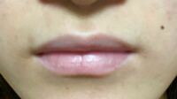 この唇 厚い方ですよね 上唇が薄くて下唇は普通くらいの形が理 Yahoo 知恵袋