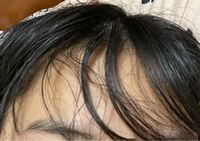 汚い画像すみません 前髪についてなんですが 写真のよう Yahoo 知恵袋