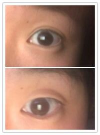 眉毛を上にあげて 元に戻すと二重になります でも 瞬きをすると元に戻りま Yahoo 知恵袋