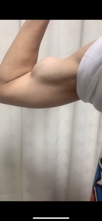 高校生です 腕の筋肉あると思いますか 運動部ではないので痩せてるんで Yahoo 知恵袋