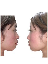 すみません 失礼します 顔の横から見た形がコンプレックスです 一瞬アデ Yahoo 知恵袋