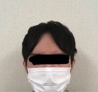25歳です これは薄毛でしょうか おでこは生まれつき広く指4本分くらい Yahoo 知恵袋