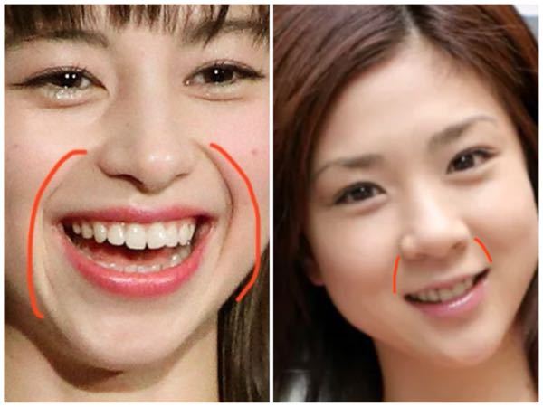 この赤い線の部分は 若い人の場合でも ほうれい線 と呼びますか Yahoo 知恵袋