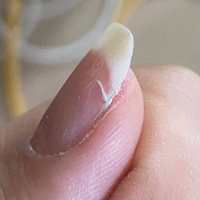 5日前に初めてスカルプをしてもらいました ですがもう右側 Yahoo 知恵袋