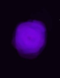 自分は高校生で小さい頃から目をつぶったり暗いところにいくと丹 Yahoo 知恵袋