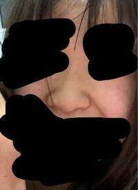 この鼻がとても気に入らなくて整形したいです 施術 どれ Yahoo 知恵袋