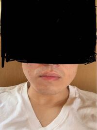 顎関節症で顎が硬く痛いです エラボトックスを検討しているのですがこの写 Yahoo 知恵袋