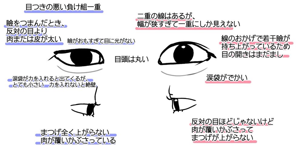 次の夏休みに整形したいです 雌雄眼 瞼激重 蒙古襞激重の左右 Yahoo 知恵袋