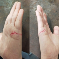 手相について 結婚線のところに左右の手どちらとも複雑な線があります 画 Yahoo 知恵袋