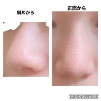 鼻の横幅って何cmありますか 平均いくつでしょうか 自分は鼻が大きい Yahoo 知恵袋