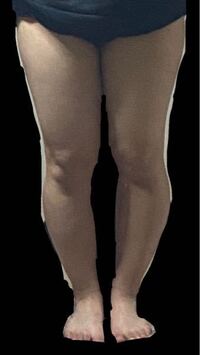 お見苦しい写真すみません 中学2年生バスケ部の女子なの Yahoo 知恵袋