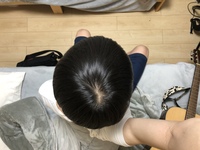 薄毛の男性がパーマをかけると どうなりますか 頭皮がスケスケで Yahoo 知恵袋