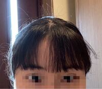 至急 高校1年生女子です 前髪の真ん中の方がいつも割れてしまい Yahoo Beauty
