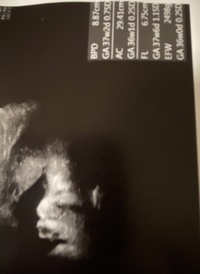 臨月 36週 に入りはじめての妊婦検診をしたのですがエコー写 Yahoo 知恵袋