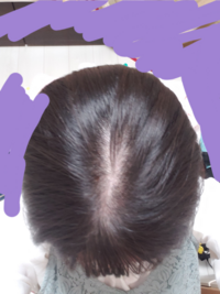 これってつむじ巻いてますか つむじは渦巻状になっているといい Yahoo 知恵袋