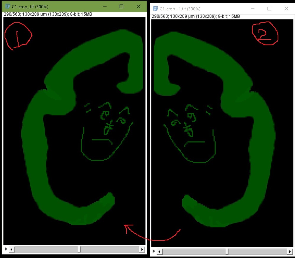 FIJI(ImageJ)で表示した560枚のStack画像（ - Yahoo!知恵袋