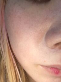 ファンデーションを塗ると写真のように毛穴にファンデが入り込ん Yahoo 知恵袋