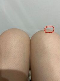 膝の痛みについて 30代女です ここ数ヶ月で 膝の痛みが日に日に Yahoo 知恵袋