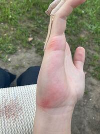 手刀の鍛錬の仕方について教えてください 手刀の鍛錬をす Yahoo 知恵袋