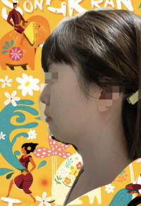 横顔ブスです 正面から見ると普通だけど横から見るとヤバイ と Yahoo 知恵袋