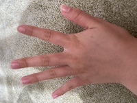 次のことを教えてください 指の関節部分のしわの改善方法 爪のピンクの部 Yahoo 知恵袋