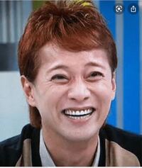 大学生で前髪が薄いのですが そんな人にも似合う髪型はあ Yahoo 知恵袋