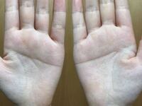 手相占いよろしくお願いします 17歳 女です 両手にま Yahoo 知恵袋