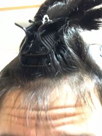 このような前髪の短い毛は剃ったり抜いたりしたほうが良いのでしょう Yahoo 知恵袋
