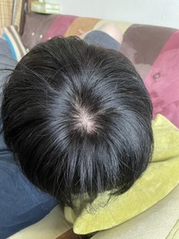 45歳です つむじが大丈夫でしょうか 禿げてませんか 白髪なんで染めて Yahoo 知恵袋