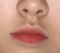 私の妹が 鼻の下が黒いことで悩んでいます 唇の影なのか黒ずみなのか Yahoo 知恵袋