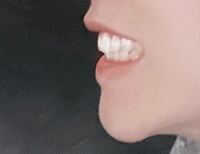 写真あり これって出っ歯気味ですか 真っ直ぐです 顎 Yahoo 知恵袋