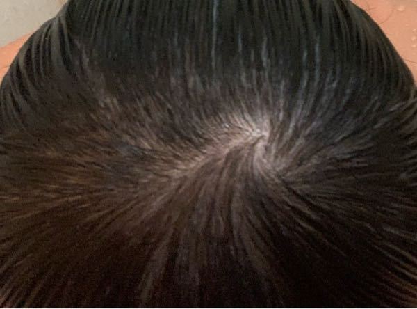 元々髪が細くて猫っ毛なんですけど 髪が濡れている状態でこのつ Yahoo 知恵袋