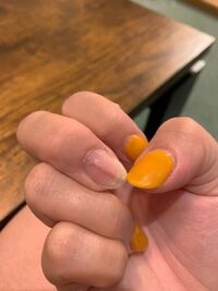 爪の黒い線について教えてください 2月下旬くらいから爪に黒い線が Yahoo 知恵袋