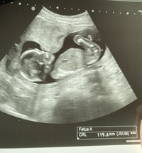 今日36w3dの検診に行ってきました 今まで順調だったのですが今 Yahoo 知恵袋