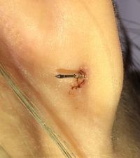 3ヶ月前にピアッサーで耳たぶにピアスを開けたのですが ファーストピアス Yahoo 知恵袋