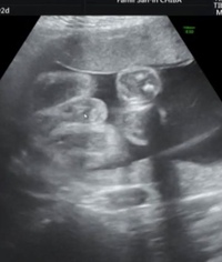 妊婦健診性別診断について 5ヶ月週 男の子a先生7ヶ月 女の Yahoo 知恵袋