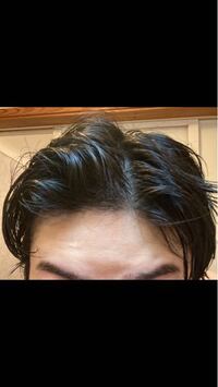 最近抜け毛が増えて髪の毛の隙間から見える頭皮の面積が増えた気 Yahoo 知恵袋